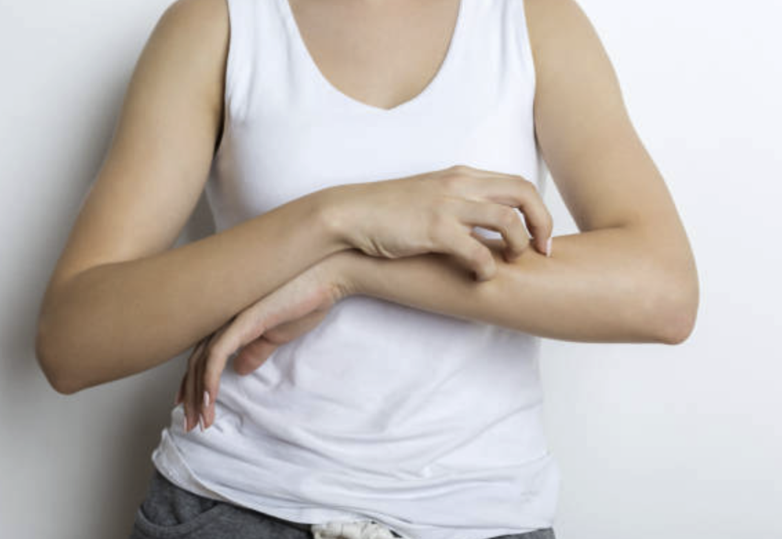 濕疹和青春痘與什麼器官有關？